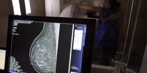 medicos-lancam-guia-para-evitar-recusa-de-mamografia-digital